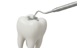 Fillings