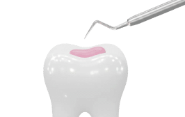 Sealants